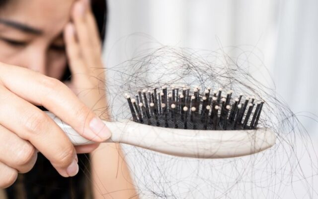 Căng thẳng dẫn đến rụng tóc 