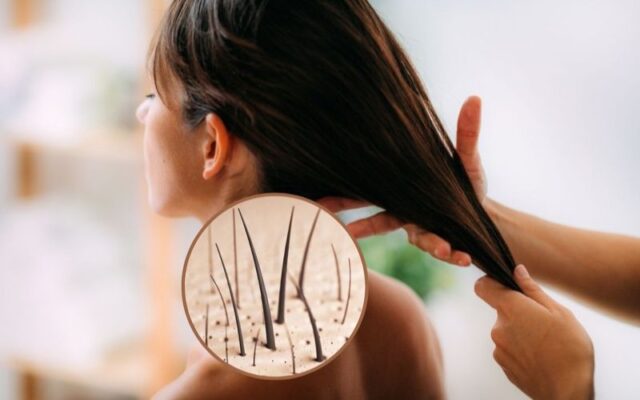 Chăm sóc đúng tóc, nang tóc khỏe 