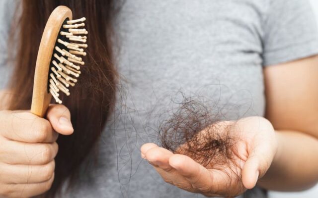 Nội tiết tố thay đổi làm rụng tóc
