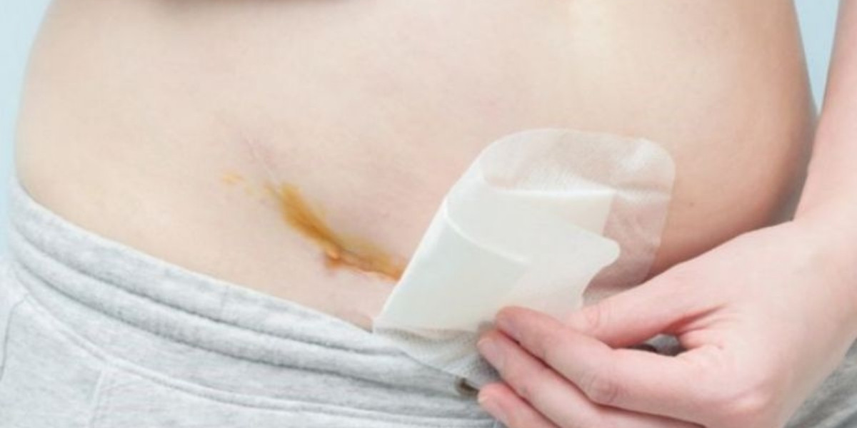 Dấu hiệu bất thường tại vết mổ