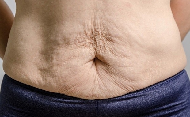 Giảm cân đối với mẹ sinh thường