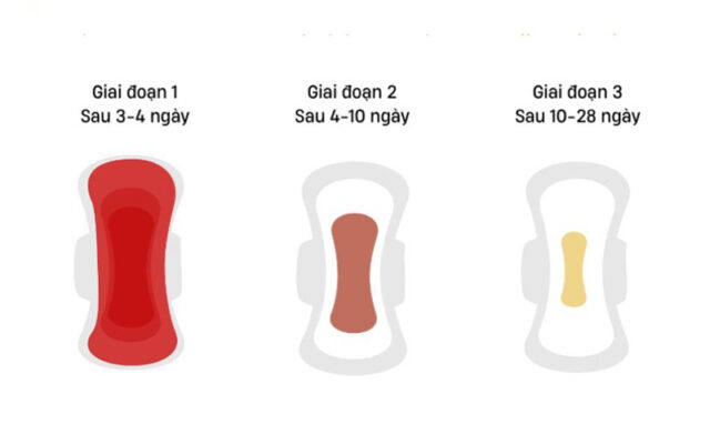 Trạng thái của sản dịch qua 4 giai đoạn