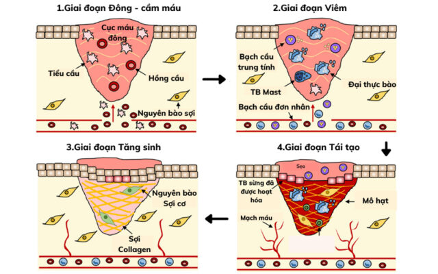 Quá trình làm lành vết mổ